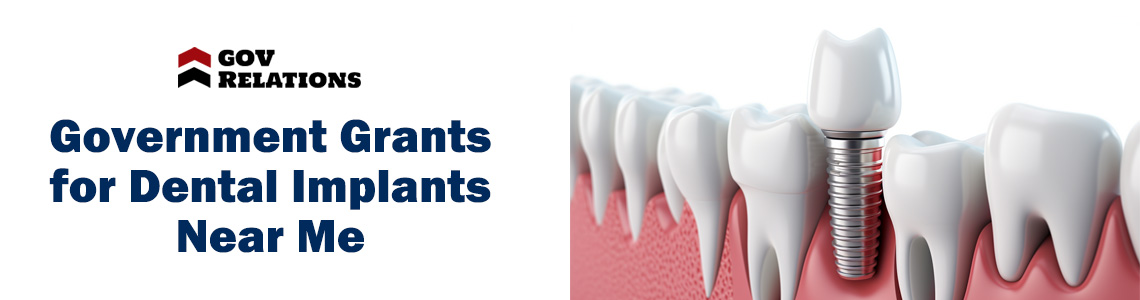 Are There Government Grants for Dental Implants Near Me?