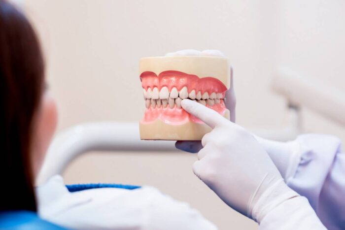 How Much Does A Mini Dental Implant Cost?